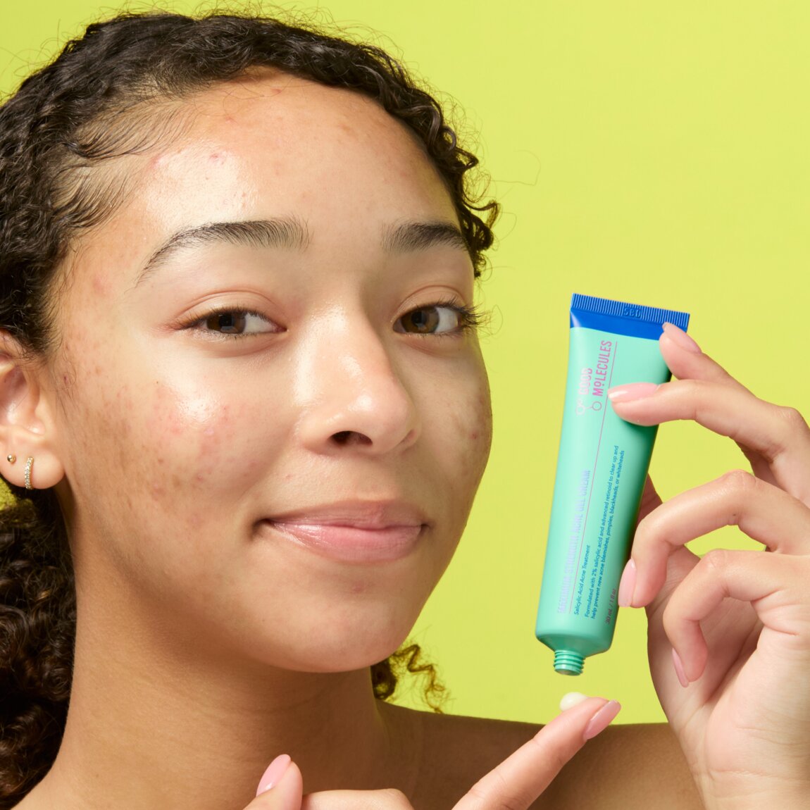 Maximum Strength Acne Gel Cream